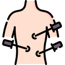 minimally-invasive-gynecological-surgeries treatmentby Dr.Anusha in puppalguda